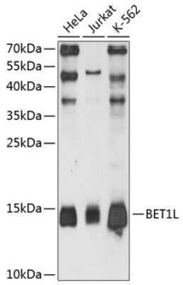 Western Blot: BET1L AntibodyAzide and BSA Free [NBP2-92050]