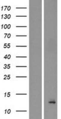 Western Blot: BET1L Overexpression Lysate [NBP2-04357]