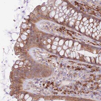 Immunohistochemistry-Paraffin: BEX2 Antibody [NBP2-33443]