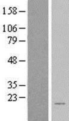 Western Blot: BEX2 Overexpression Lysate [NBL1-07971]