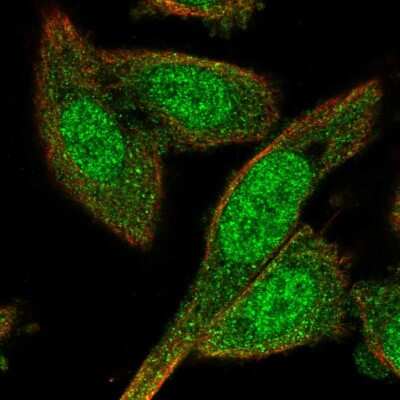 Immunocytochemistry/ Immunofluorescence: BEX4 Antibody [NBP2-55387]