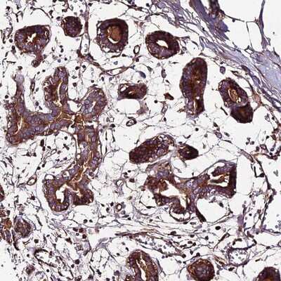 Immunohistochemistry-Paraffin: BEX4 Antibody [NBP1-91702]