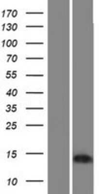 Western Blot: BEX4 Overexpression Lysate [NBP2-08491]