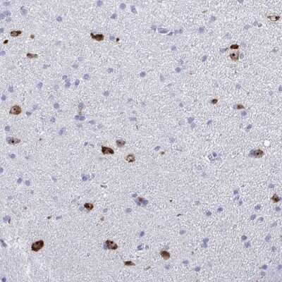 Immunohistochemistry-Paraffin: BEX5 Antibody [NBP2-32422]