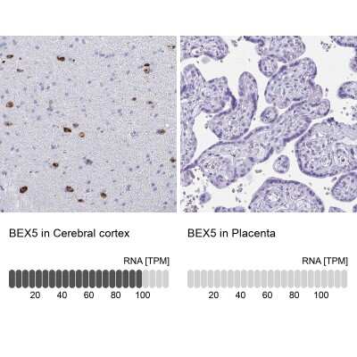Immunohistochemistry-Paraffin: BEX5 Antibody [NBP2-32422]