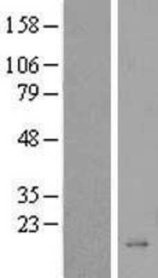 Western Blot: BEX5 Overexpression Lysate [NBP2-08711]