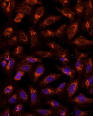 Immunocytochemistry/ Immunofluorescence: BFAR Antibody - BSA Free [NBP2-92687]