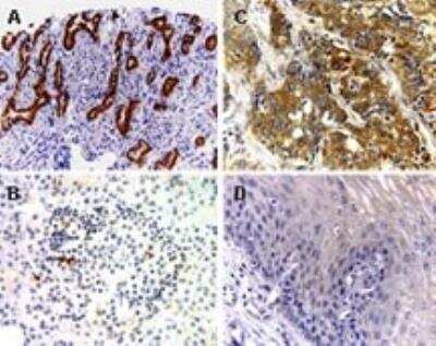 Immunohistochemistry-Paraffin: BFAR Antibody [NB100-56094]