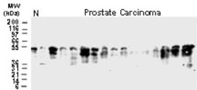 Western Blot: BFAR Antibody [NB100-56093]