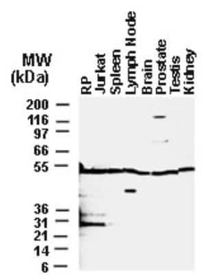 Western Blot: BFAR Antibody [NB100-56094]