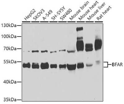 Western Blot: BFAR AntibodyBSA Free [NBP2-92687]