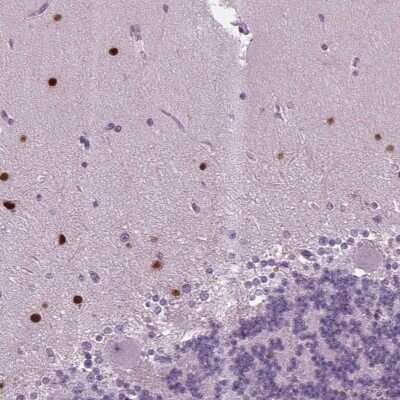 Immunohistochemistry: BHLHB5 Antibody [NBP2-39016]
