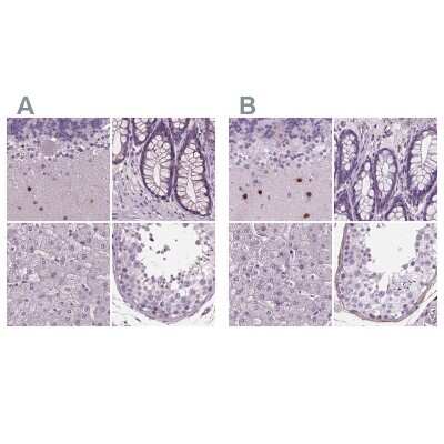 Immunohistochemistry-Paraffin: BHLHB5 Antibody [NBP2-39016]