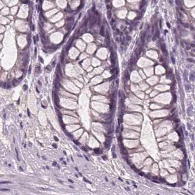 Immunohistochemistry-Paraffin: BHLHB5 Antibody [NBP2-39016]