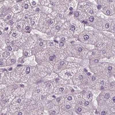 Immunohistochemistry-Paraffin: BHLHB5 Antibody [NBP2-39016]