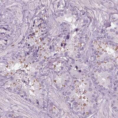 Immunohistochemistry-Paraffin: BHLHB5 Antibody [NBP2-39039]