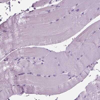 Immunohistochemistry-Paraffin: BHLHB5 Antibody [NBP2-39039]