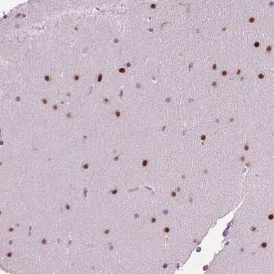 Immunohistochemistry-Paraffin: BHLHB5 Antibody [NBP2-39039]