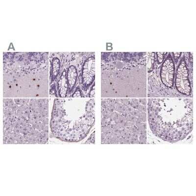 Immunohistochemistry-Paraffin: BHLHB5 Antibody [NBP2-39039]