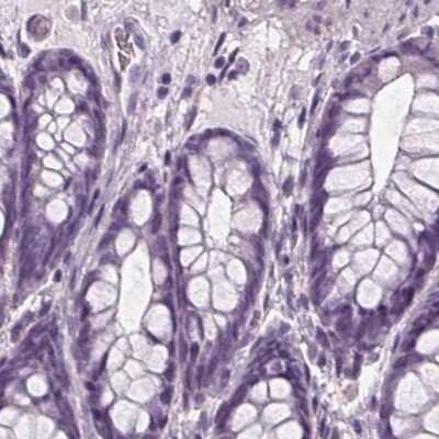 Immunohistochemistry-Paraffin: BHLHB5 Antibody [NBP2-39039]