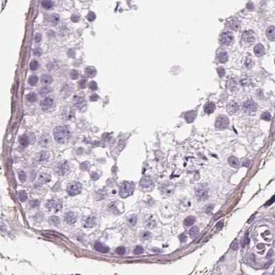 Immunohistochemistry-Paraffin: BHLHB5 Antibody [NBP2-39039]