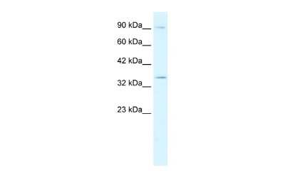 Western Blot: BHLHB5 Antibody [NBP3-10296]