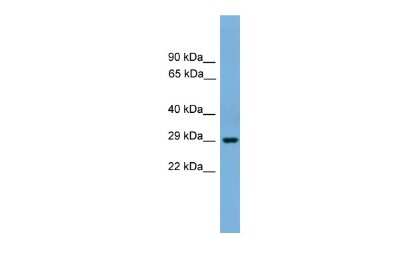 Western Blot: BHLHE23 Antibody [NBP2-82762]