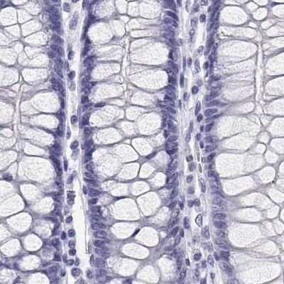 Immunohistochemistry-Paraffin: BHMT Antibody [NBP2-38850]