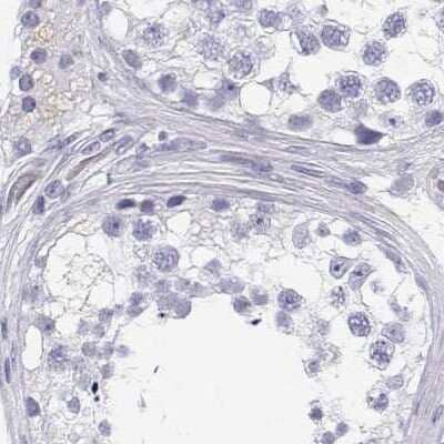 Immunohistochemistry-Paraffin: BHMT Antibody [NBP2-38850]