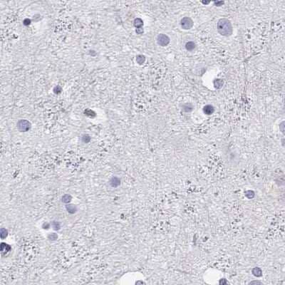 Immunohistochemistry-Paraffin: BHMT Antibody [NBP2-38850]