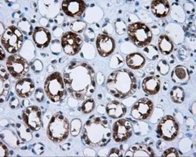 Immunohistochemistry: BHMT Antibody (OTI3E11) - Azide and BSA Free [NBP2-70250]