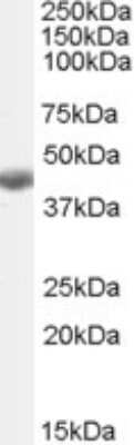 Western Blot: BHMT Antibody [NBP1-00161]