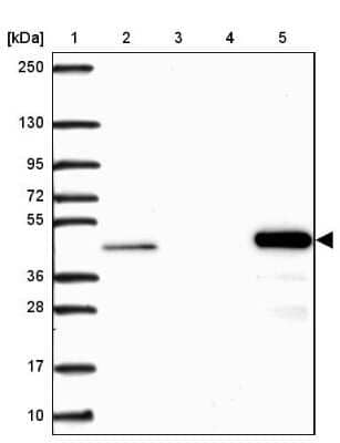 Western Blot: BHMT Antibody [NBP2-38850]