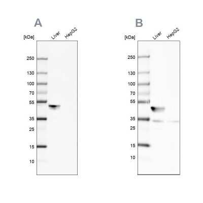 Western Blot: BHMT Antibody [NBP2-38850]