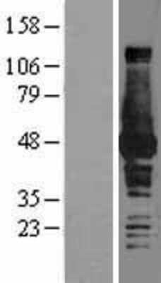 Western Blot: BHMT Overexpression Lysate [NBL1-07976]