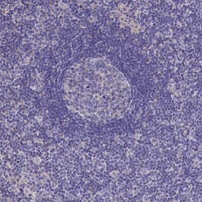 Immunohistochemistry-Paraffin: BHMT2 Antibody [NBP1-85826]