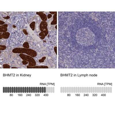 Immunohistochemistry-Paraffin: BHMT2 Antibody [NBP1-85826]