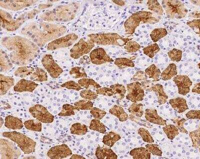 Immunohistochemistry-Paraffin: BHMT2 Antibody [NBP3-12685]