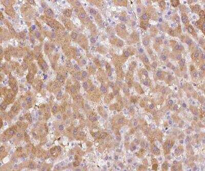 Immunohistochemistry-Paraffin: BHMT2 Antibody [NBP3-12685]