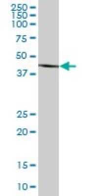 Western Blot: BHMT2 Antibody [H00023743-B01P]