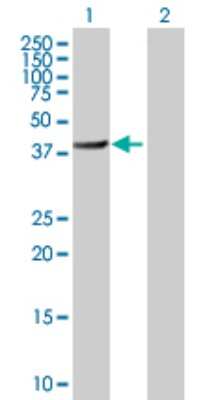 Western Blot: BHMT2 Antibody [H00023743-B01P]