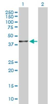 Western Blot: BHMT2 Antibody [H00023743-D01P]