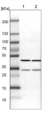 Western Blot: BHMT2 Antibody [NBP1-85826]