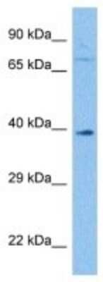 Western Blot: BHMT2 Antibody [NBP3-10794]