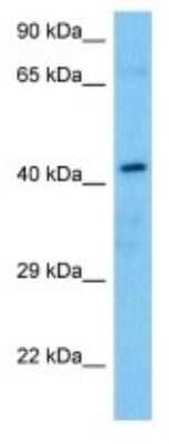 Western Blot: BHMT2 Antibody [NBP3-10819]