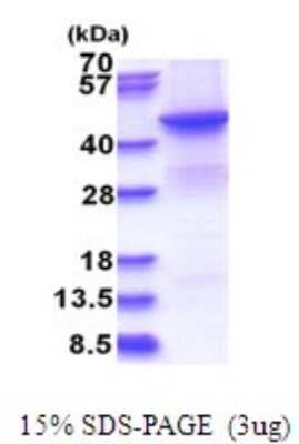 SDS-PAGE: Recombinant Human BHMT2 His Protein [NBP2-51685]