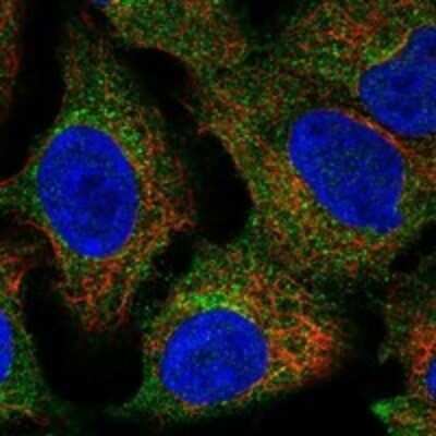 Immunocytochemistry/ Immunofluorescence: BICC1 Antibody [NBP3-17469]