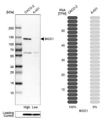 Western Blot: BICC1 Antibody [NBP1-94171]