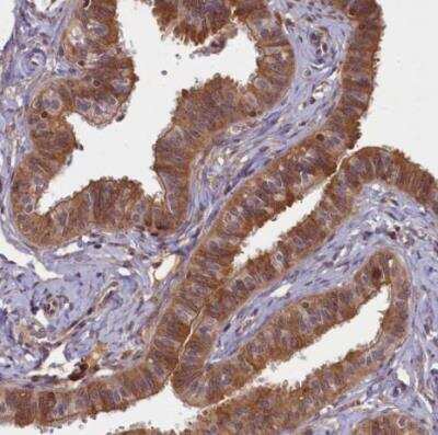 Immunohistochemistry-Paraffin: BICD1 Antibody [NBP1-85843]
