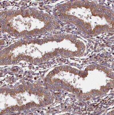 Immunohistochemistry-Paraffin: BICD1 Antibody [NBP1-85843]